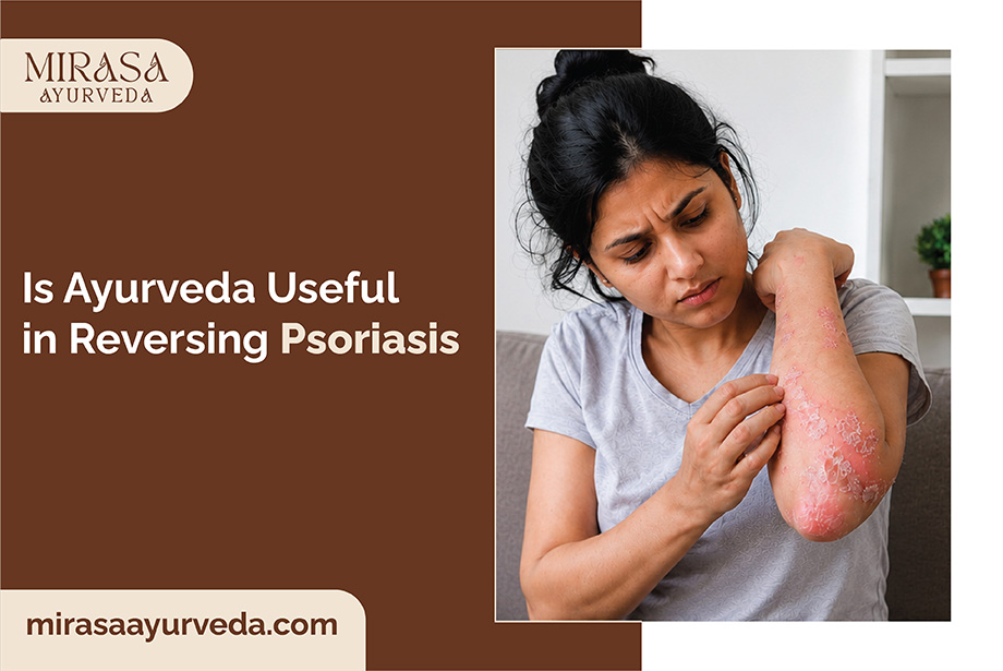 Psoriasis